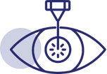 Cataract surgery icon